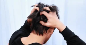 Jeuk na een haartransplantatie