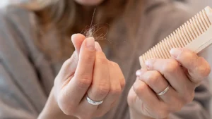 Hoeveel haren verlies je per dag? En wat is normaal haarverlies?