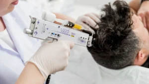 Mesotherapie haar Den Haag