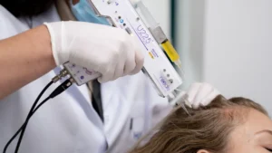 Mesotherapie haar werkt niet? De feiten, nadelen en alternatieven