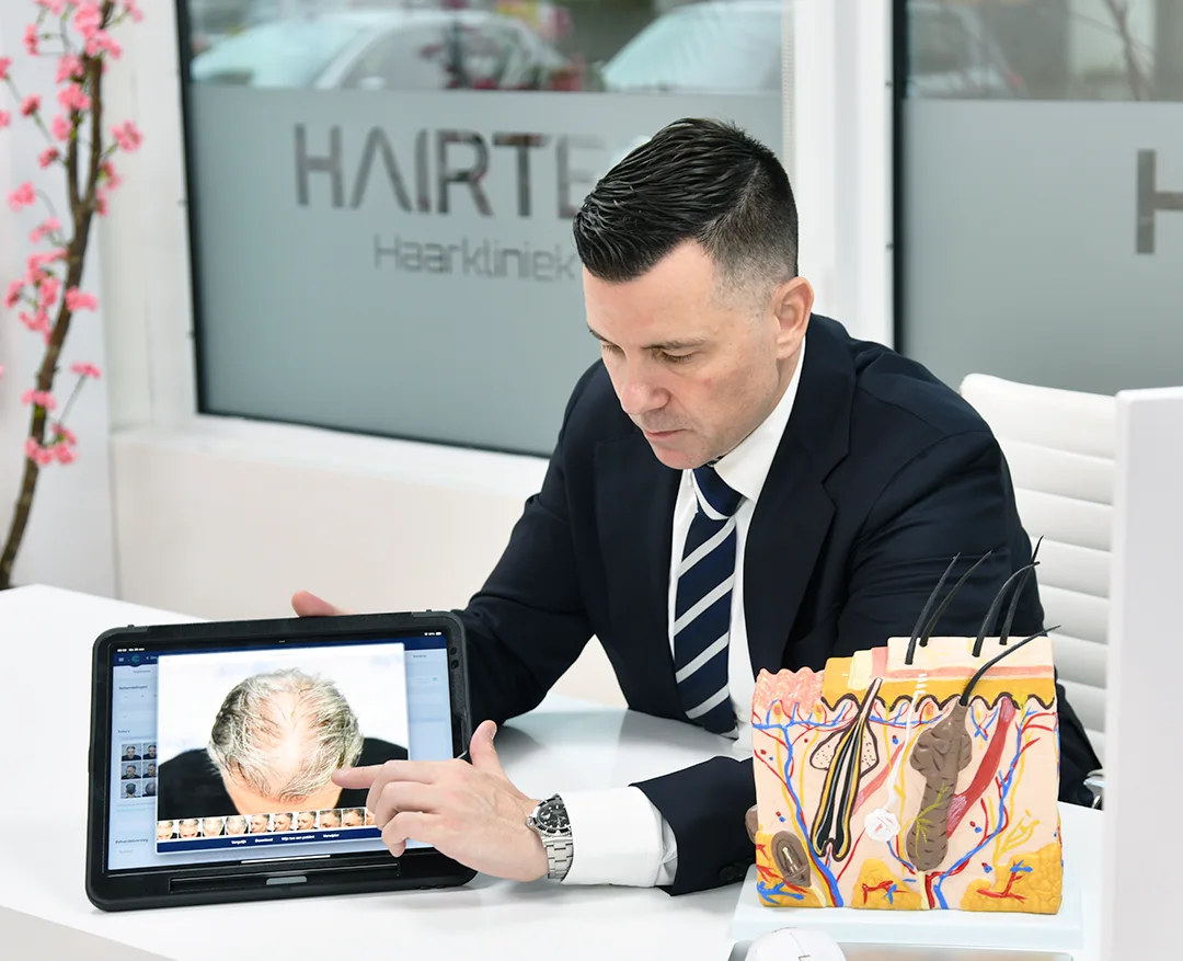 <h3>Transparantie en een all-in prijs bij Hairtec Haarkliniek</h3>