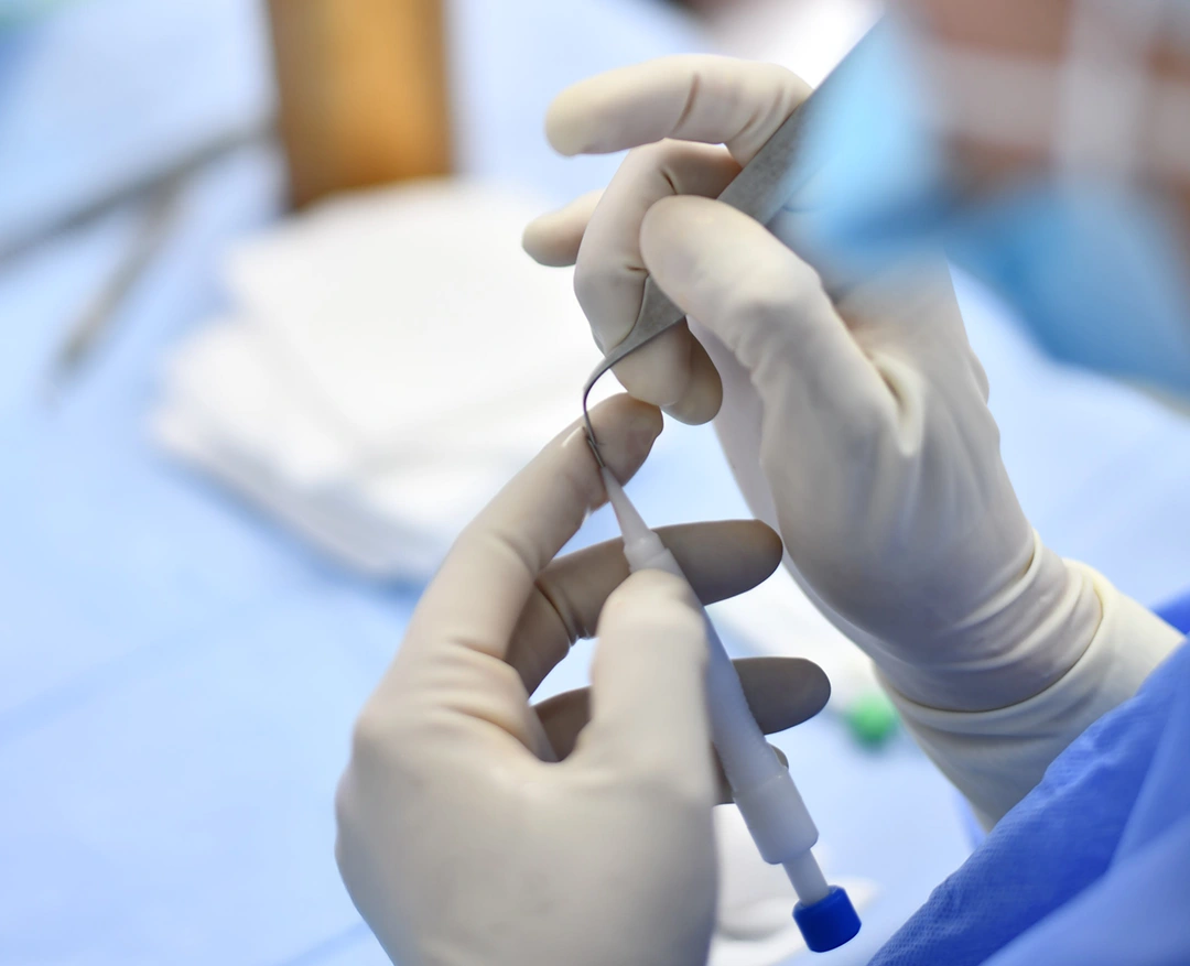<h3>Sneller herstel dankzij geavanceerde technieken bij de haartransplantatie</h3>