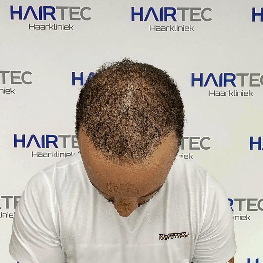 After Image