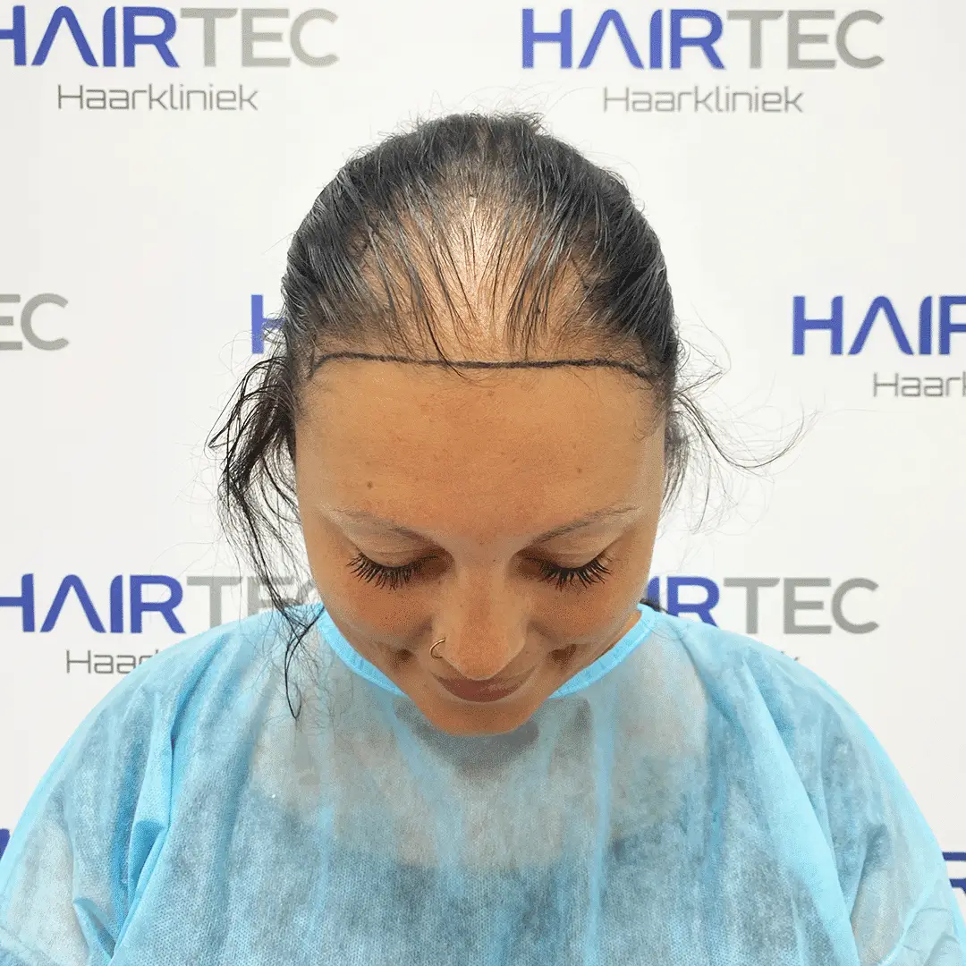 Before Image