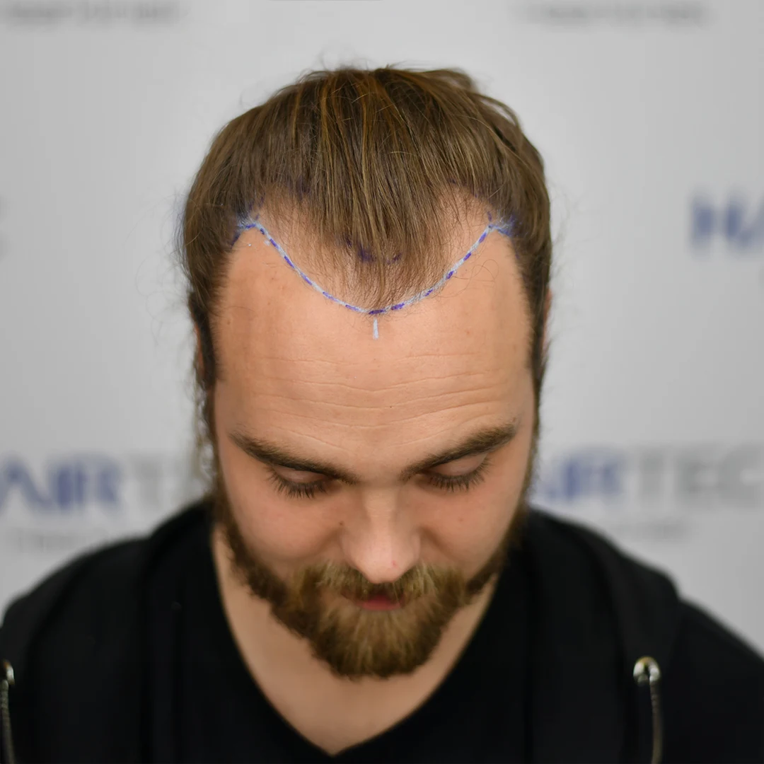 Before Image