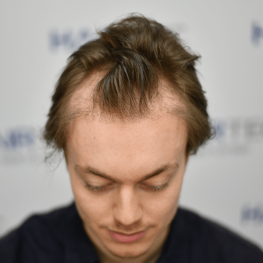 Before Image