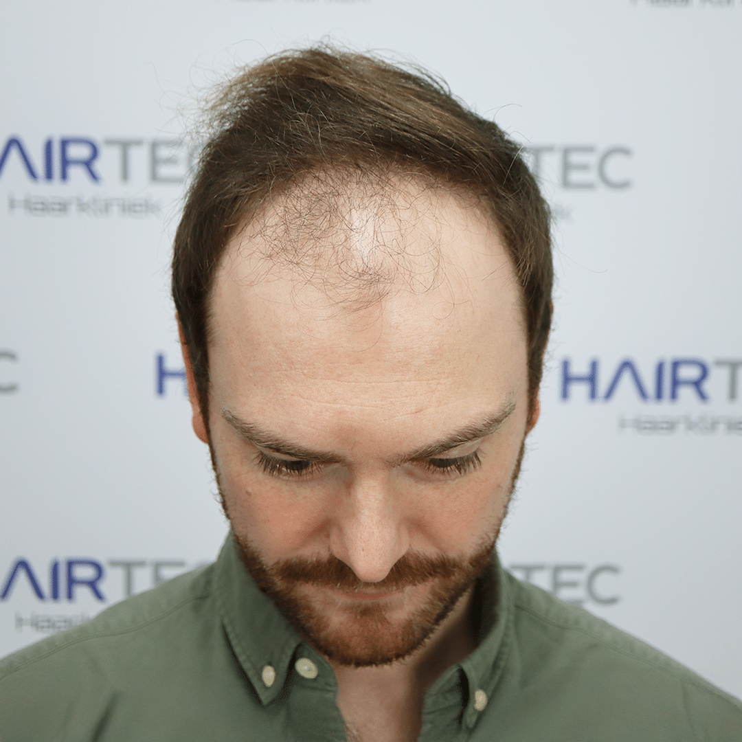 Before Image