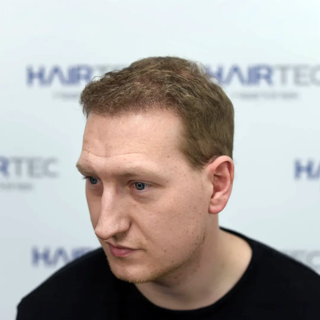 After Image