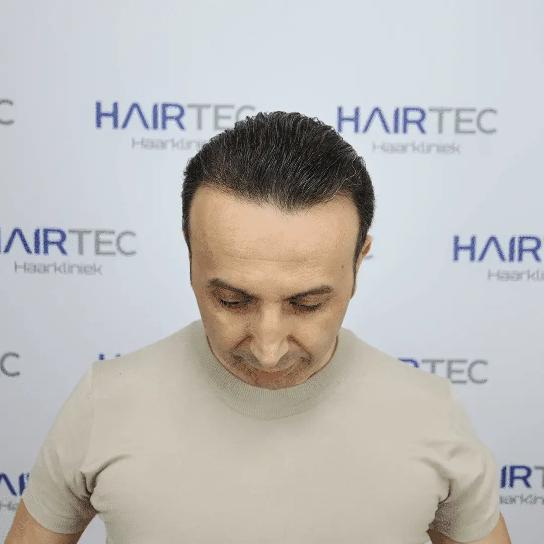 After Image