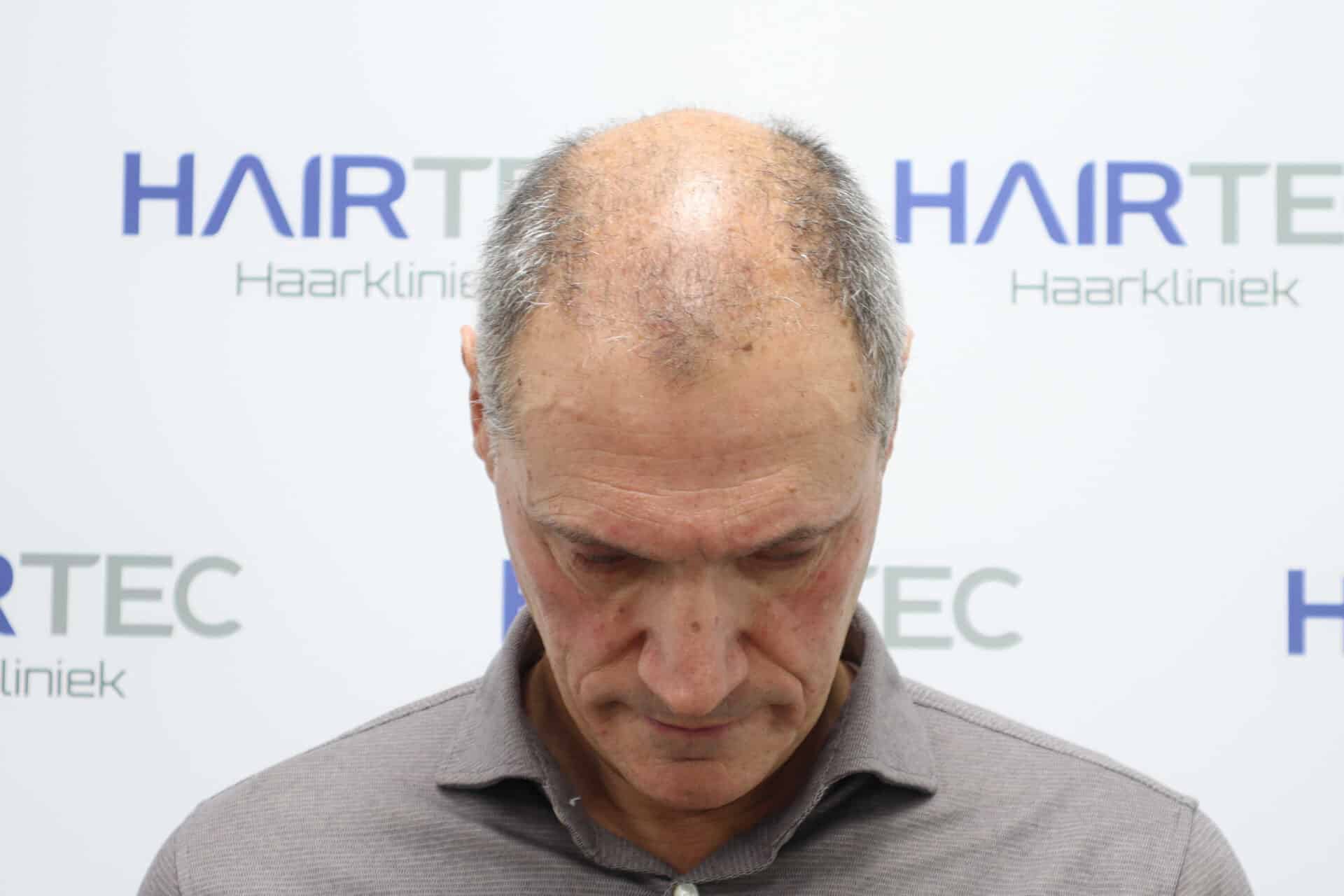 Before Image