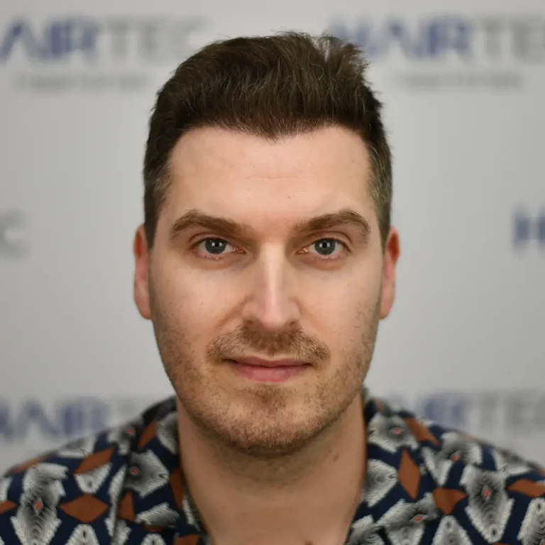 tom dice voor en na foto resultaat
