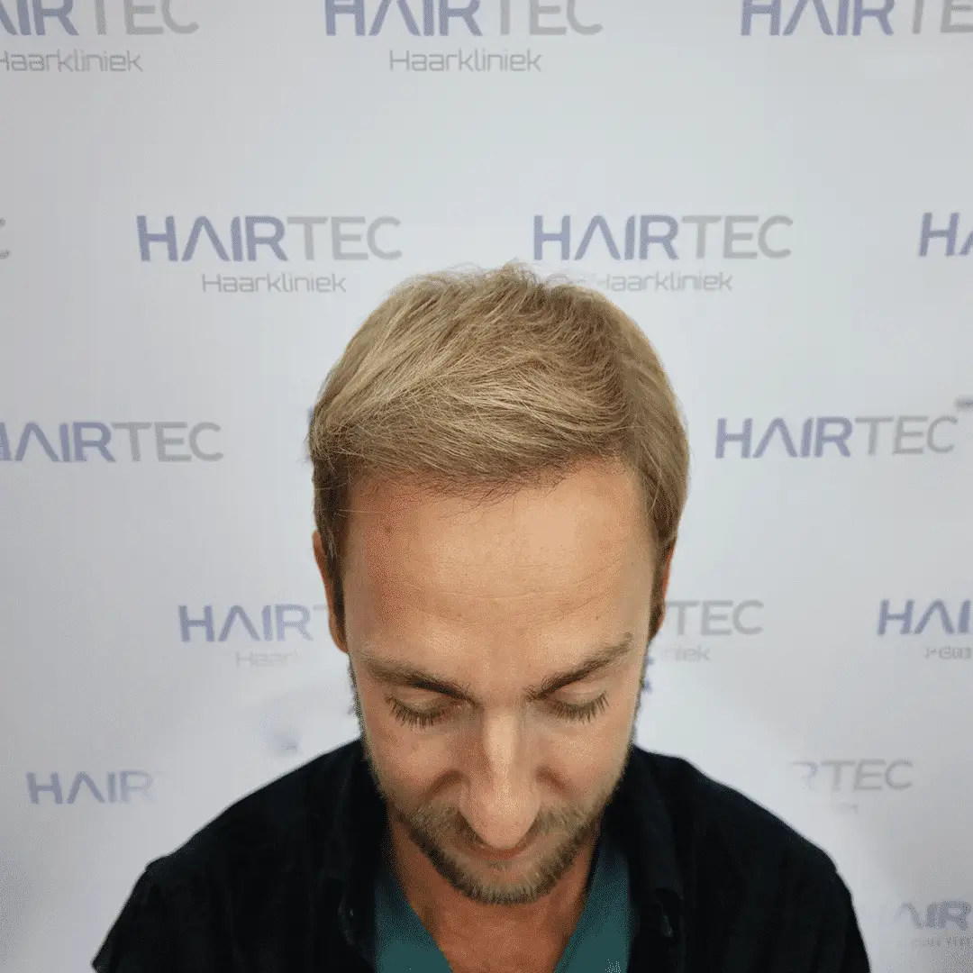 After Image