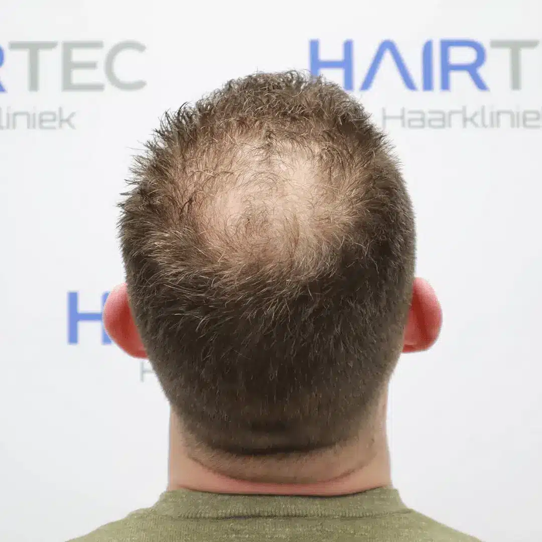 Before Image