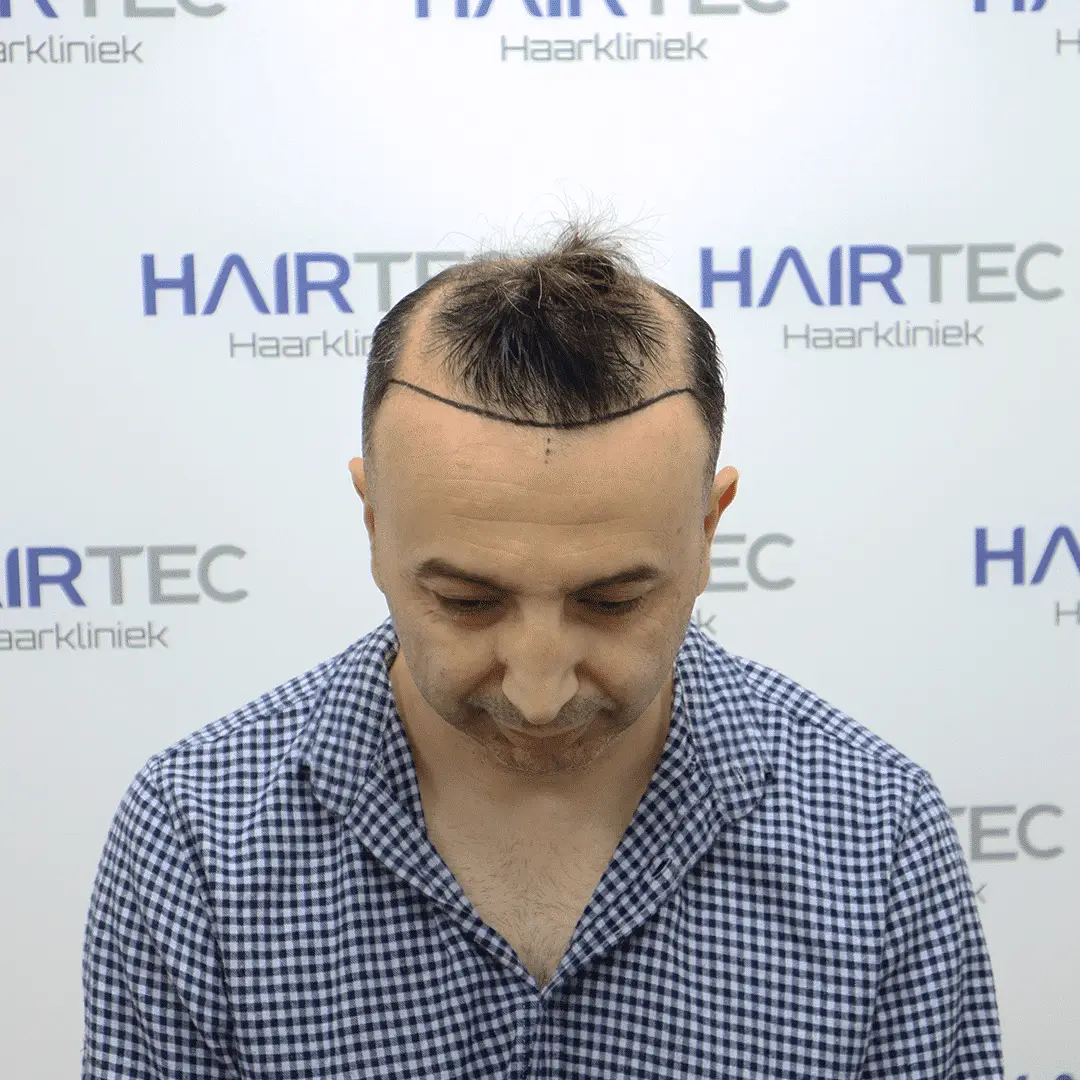 Before Image