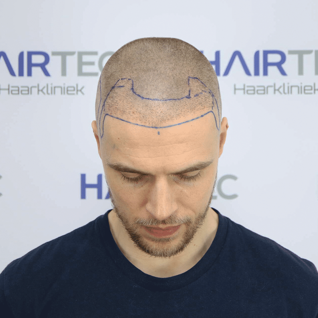 Before Image