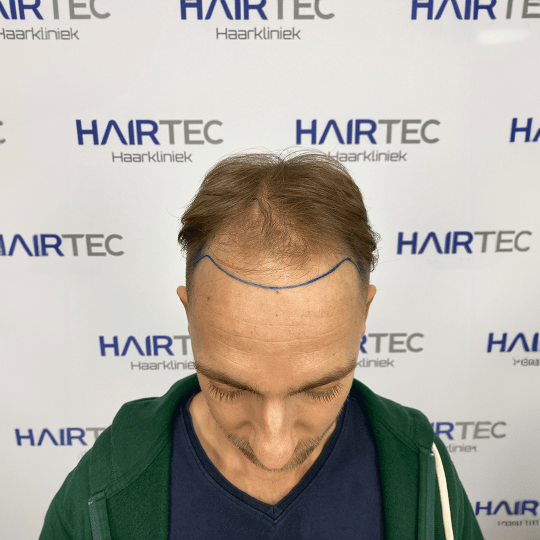 Before Image