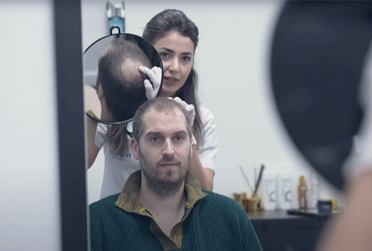 tom dice haartransplantatie interview banner