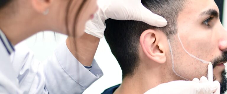 baard-en-snor-transplantatie-slider