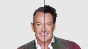 Haartransplantatie Gerard Joling: Wat weten we echt?