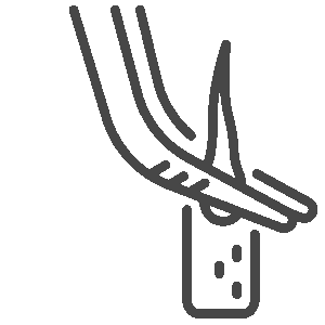 Directe implantatie van de haarzakjes