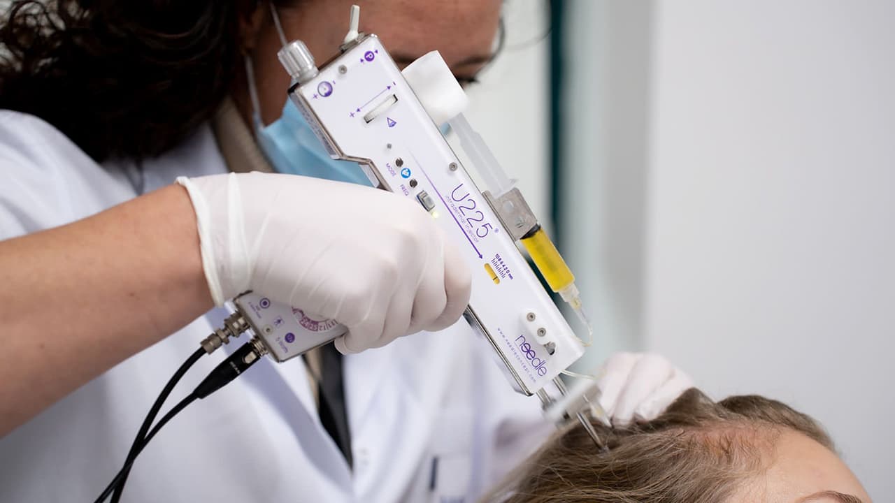 plasma behandeling haar