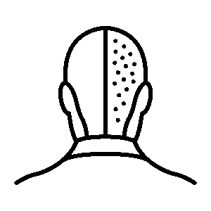 Snel herstel van de hoofdhuid